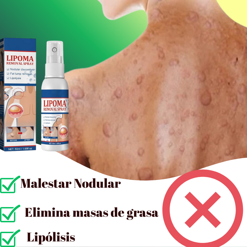 LIPOMAX: SPRAY ELIMINADOR DE LIPOMAS