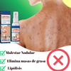 LIPOMAX: SPRAY ELIMINADOR DE LIPOMAS